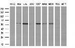 ATP6V1B1 Antibody in Western Blot (WB)