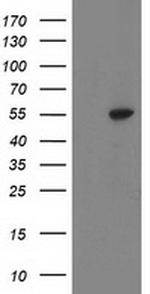 ATP6V1B1 Antibody in Western Blot (WB)