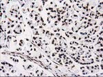 ATP6V1F Antibody in Immunohistochemistry (Paraffin) (IHC (P))