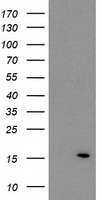 ATP6V1F Antibody in Western Blot (WB)