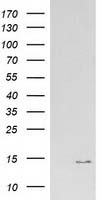 ATP6V1F Antibody in Western Blot (WB)