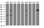 ATRIP Antibody in Western Blot (WB)