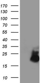 AVPI1 Antibody in Western Blot (WB)