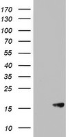 AVPI1 Antibody in Western Blot (WB)