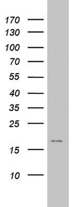 AVPI1 Antibody in Western Blot (WB)