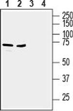 ZIP6/SLC39A6 (extracellular) Antibody in Western Blot (WB)