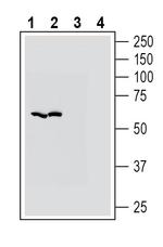 ZIP14 (SLC39A14) Antibody in Western Blot (WB)