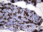 Acidic Cytokeratin Antibody in Immunohistochemistry (Paraffin) (IHC (P))