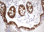 Acidic Cytokeratin Antibody in Immunohistochemistry (Paraffin) (IHC (P))