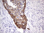 Acidic Cytokeratin Antibody in Immunohistochemistry (Paraffin) (IHC (P))