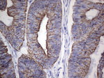 Acidic Cytokeratin Antibody in Immunohistochemistry (Paraffin) (IHC (P))