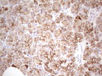 Basic Cytokeratin Antibody in Immunohistochemistry (Paraffin) (IHC (P))