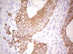 Basic Cytokeratin Antibody in Immunohistochemistry (Paraffin) (IHC (P))