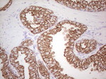 Basic Cytokeratin Antibody in Immunohistochemistry (Paraffin) (IHC (P))