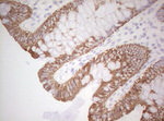 Basic Cytokeratin Antibody in Immunohistochemistry (Paraffin) (IHC (P))