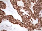 Basic Cytokeratin Antibody in Immunohistochemistry (Paraffin) (IHC (P))