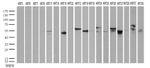 Acidic Cytokeratin Antibody in Western Blot (WB)