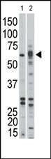 ACVR1B Antibody in Western Blot (WB)