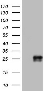 Adiponectin Antibody in Western Blot (WB)