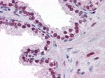 Androgen Receptor Antibody in Immunohistochemistry (Paraffin) (IHC (P))