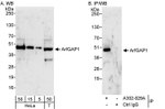 ArfGAP1 Antibody in Western Blot (WB)
