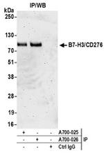 B7-H3/CD276 Antibody in Western Blot (WB)