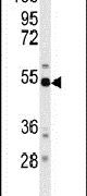 BACE1 Antibody in Western Blot (WB)