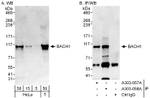 BACH1 Antibody in Western Blot (WB)