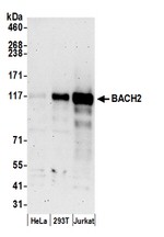 BACH2 Antibody in Western Blot (WB)