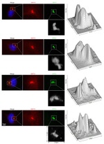 BAP31 Antibody in Immunocytochemistry (ICC/IF)