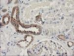 BCAR1 Antibody in Immunohistochemistry (Paraffin) (IHC (P))