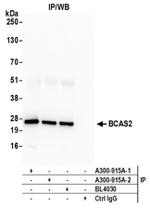 BCAS2 Antibody in Western Blot (WB)