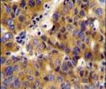 BCKDHB Antibody in Immunohistochemistry (IHC)