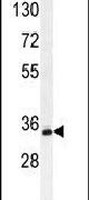 BCKDHB Antibody in Western Blot (WB)