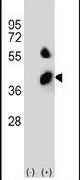 BCKDHB Antibody in Western Blot (WB)