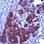 Bcl-xL Antibody in Immunohistochemistry (IHC)