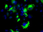 BCL10 Antibody in Immunocytochemistry (ICC/IF)