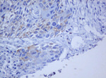 BCL10 Antibody in Immunohistochemistry (Paraffin) (IHC (P))