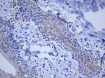 BCL10 Antibody in Immunohistochemistry (Paraffin) (IHC (P))