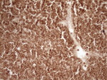 BCL2 Antibody in Immunohistochemistry (Paraffin) (IHC (P))