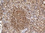 BCL2 Antibody in Immunohistochemistry (Paraffin) (IHC (P))