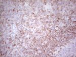 BCL2 Antibody in Immunohistochemistry (Paraffin) (IHC (P))