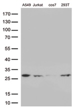 BCL2 Antibody in Western Blot (WB)