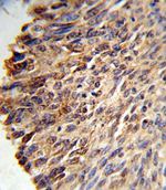 Bcl-3 Antibody in Immunohistochemistry (IHC)