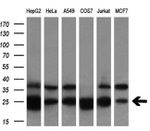 BDH2 Antibody in Western Blot (WB)