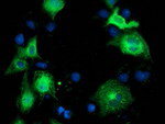 BECN1 Antibody in Immunocytochemistry (ICC/IF)