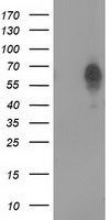 BEST3 Antibody in Western Blot (WB)