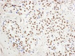 BHC110/LSD1 Antibody in Immunohistochemistry (IHC)