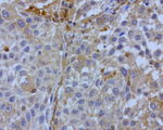 BID Antibody in Immunohistochemistry (Paraffin) (IHC (P))