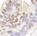 BLAP75 Antibody in Immunohistochemistry (IHC)